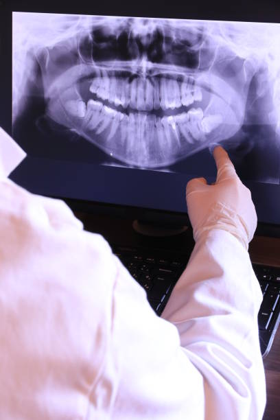 Best Walk-In Emergency Dentist in Davenport, IA