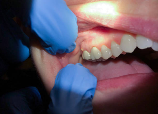 Best Emergency Broken Tooth Repair in Davenport, IA