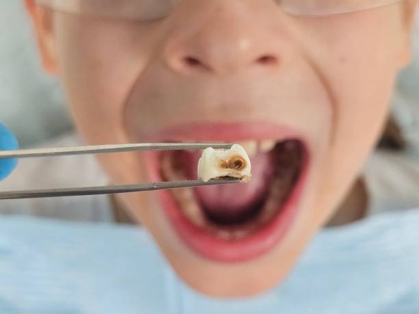 Best Weekend Emergency Dentist in Davenport, IA